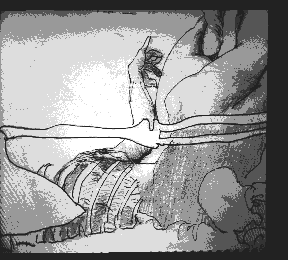 PIC2[PIC,LCS]